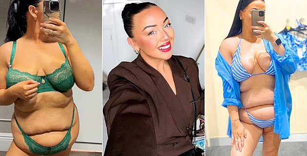 Vytahané bříško žena hrdě ukazuje a zbavovat se ho nechce, jde příkladem