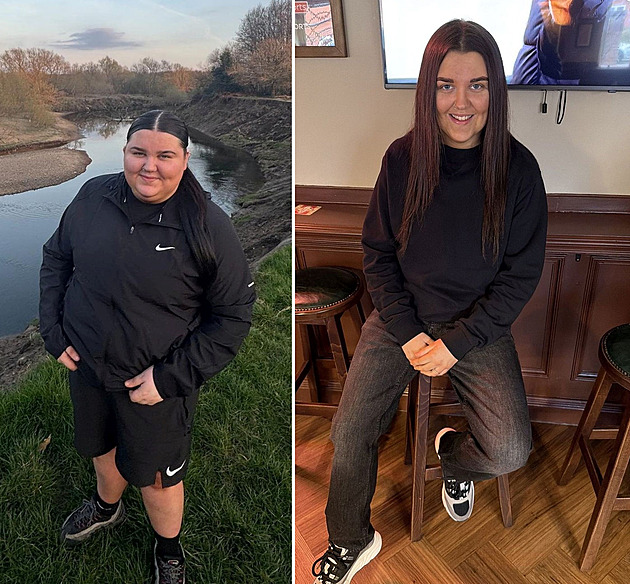 Diagnóza cukrovky mladou ženu šokovala. Díky injekcím radikálně zhubla